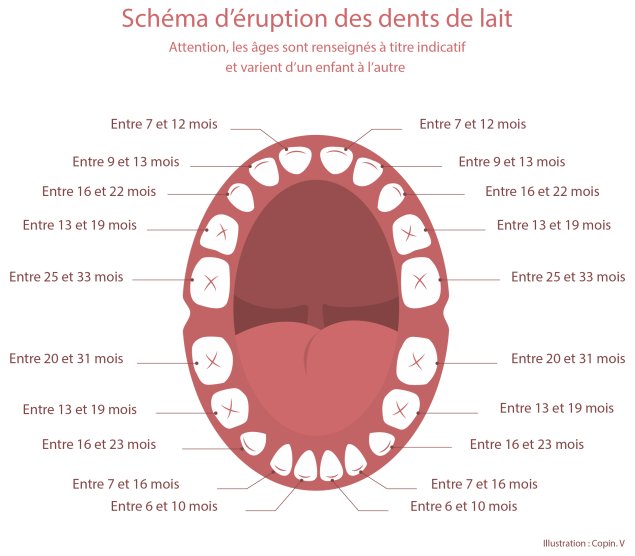 Eruption dentaire